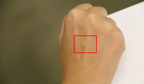 春雨君的包子手(捂脸.jpg)重点来了,什么样的肿块可能是癌症前兆?