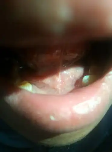 不痛不痒.有时不见有时又有