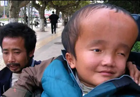 全球最恐怖的怪病zt【慎入】