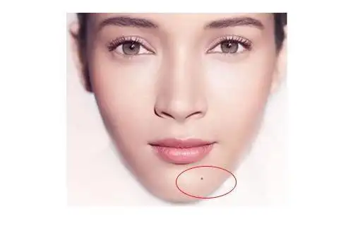 ①地库有痣面相中的地库位置在于下巴两侧,以浑圆饱满为最佳,这样的人