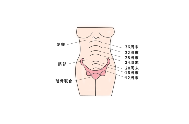 都是相同孕周的孕妇,肚子的差别怎么就这么大呢?_宫高