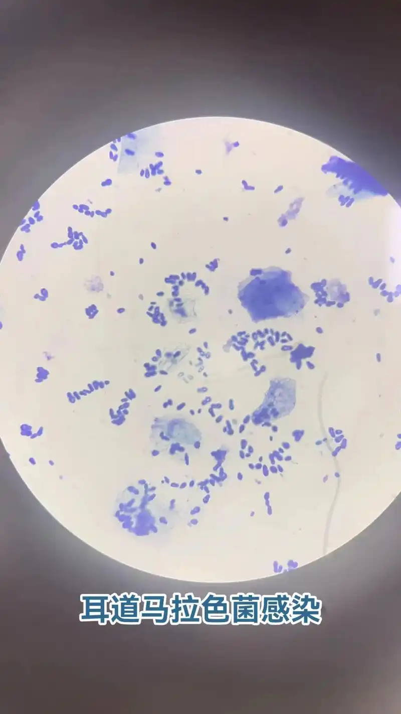 耳道马拉色菌感染|显微镜镜检.如果犬猫耳朵瘙痒,出现抓挠蹭头 - 抖音