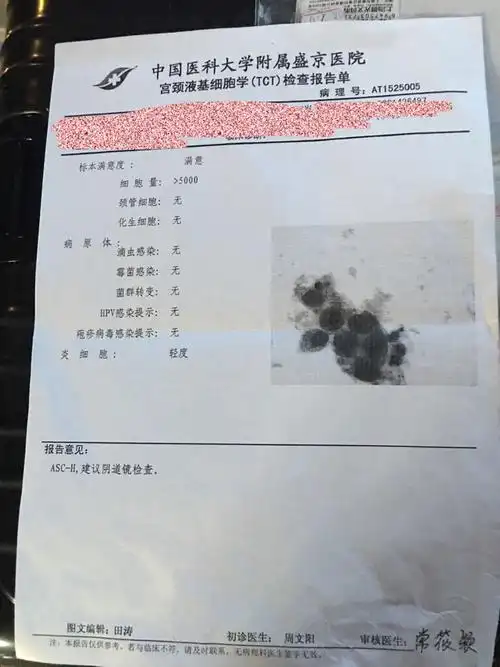鳞状细胞癌相关抗原5.8 请问是不是很严重