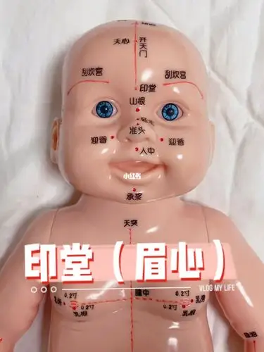 小儿推拿印堂眉心醒脑安神祛风通窍