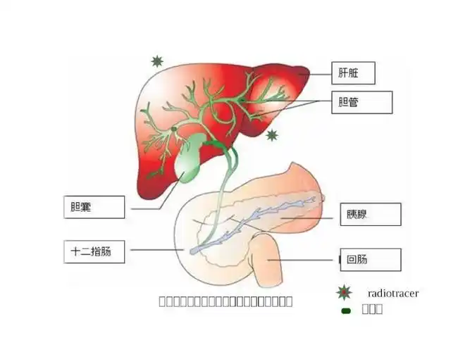 肝胆显像( hepatobiliary scintigraphy )