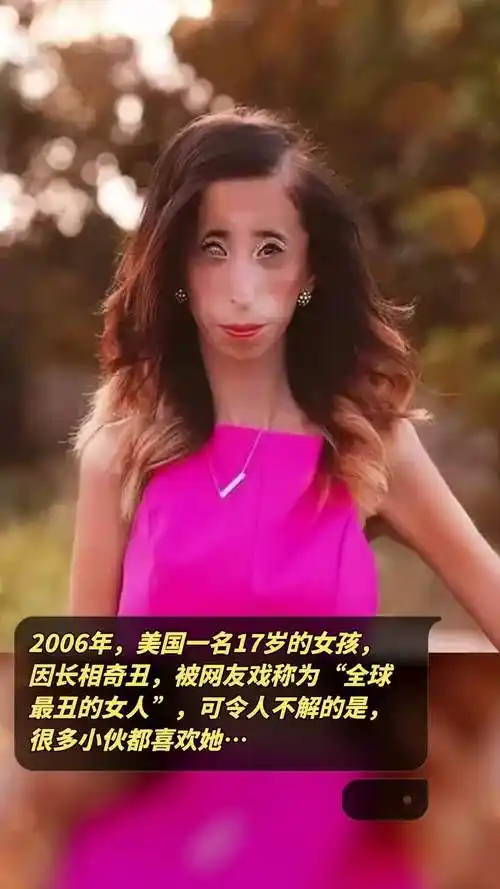 2006年美国一名17岁的女孩因长相奇丑被网友戏称为全球最丑的女人可