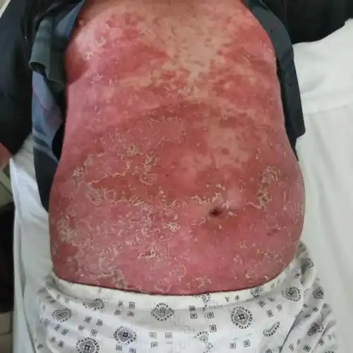 围观男子皮肤像癞蛤蟆10年无果