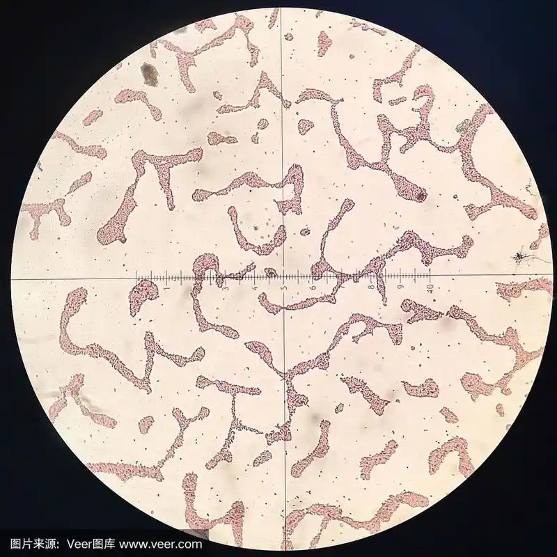 青霉菌的显微照片