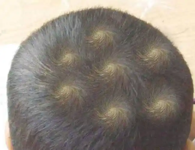 相术 头上几个旋代表什么  每个人头上都有旋,可能位置不太一样,有的