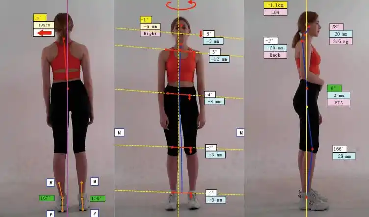 健康源于良好体态