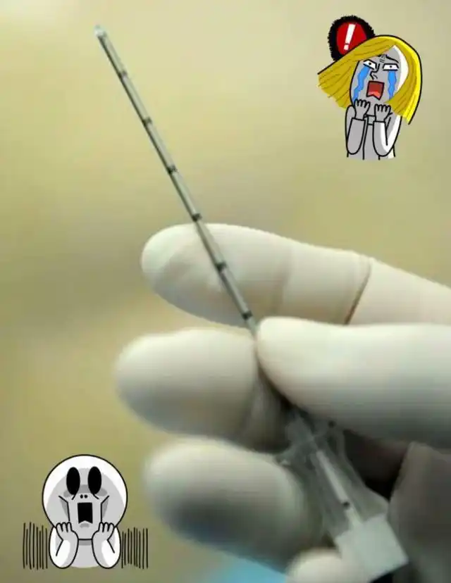 原创剖腹产就是打一针睡一觉看看这根腰椎针的长度还仅仅是个开头