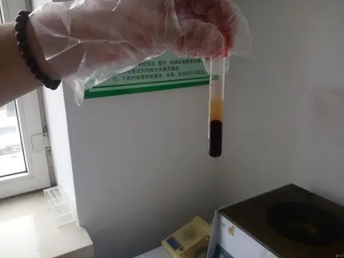 血液离心后