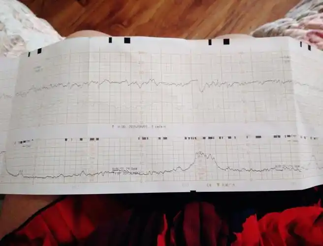 36周胎头入盆只看楼主