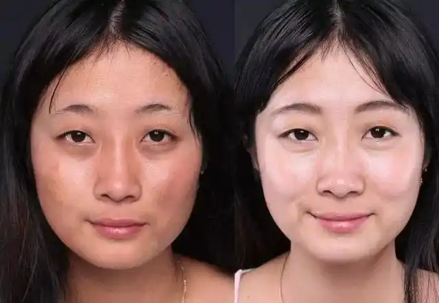 蛋白糖化,然后可怕的皱纹,暗沉也就慢慢产生了,这就是"黄脸婆"的来源