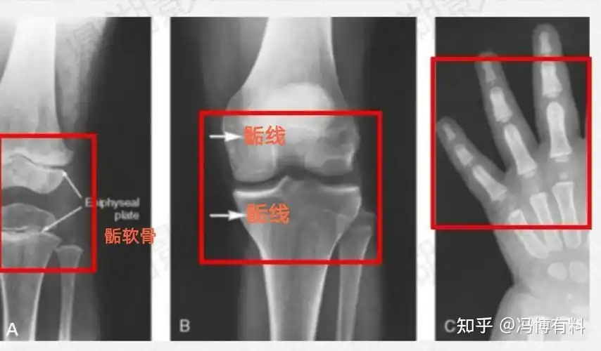个子矮什么原因? - 知乎