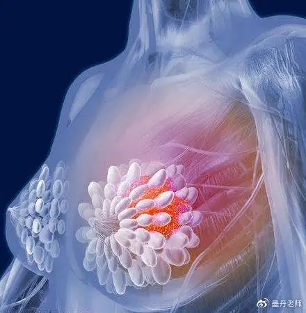 六,乳房外形变化正常乳房外形呈自然弧形,乳腺癌晚期则弧形发生严重