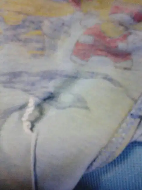 为什么我的内裤黄黄的.