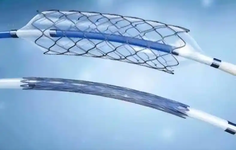 安装心脏支架后还能活多少年医生说出大实话请转告家人