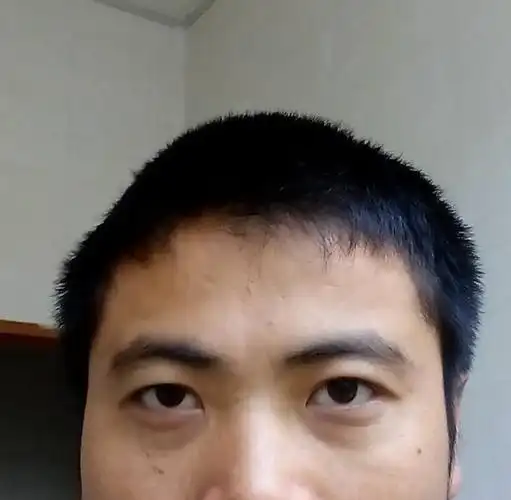 关于面相和科学的问题,我的头颅是中间凸起,左右凹陷