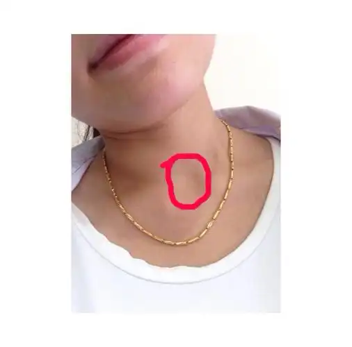 问:请问这个部位是属于咽喉还是甲状腺?