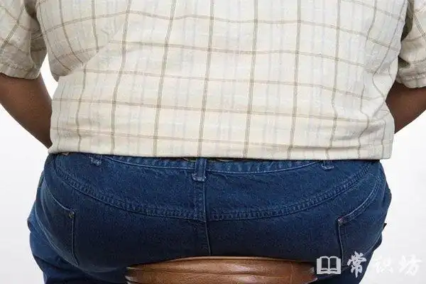 "水桶腰"也是一种脂肪肝