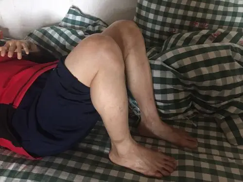 左侧膝关节能屈曲至约120度的图片