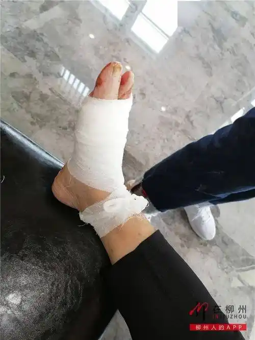 "先去雷村包扎一下,先止血.