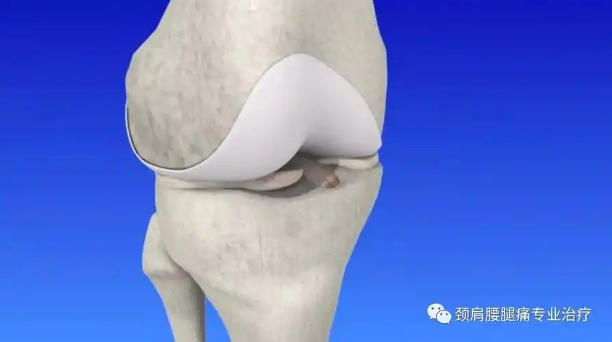 骨科疾病早知道003半月板撕裂meniscustear