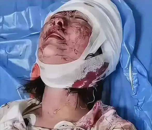 案发前饭店监控视频截图陈某志在第二打人现场——饭店门口——行凶