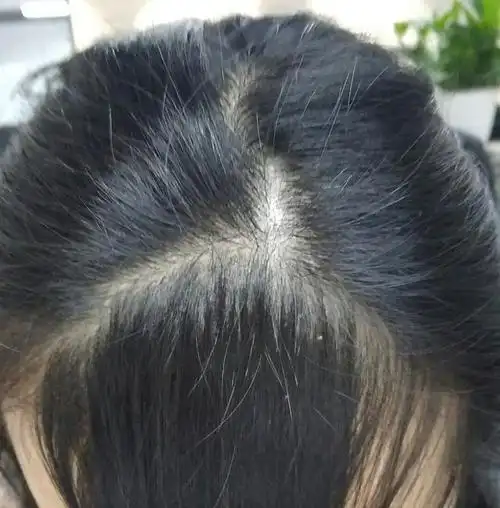 坦白剪发虫上头前期会有4个征兆细心的一眼就能发现