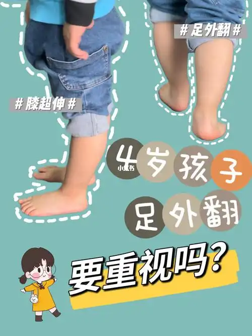 宝宝足外翻这位妈妈是这样做的