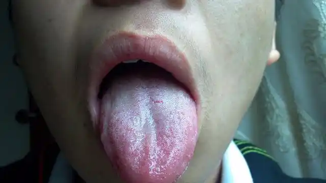 湿气重的人一般都存在舌苔厚重,并且有的舌头两侧还会出现齿痕