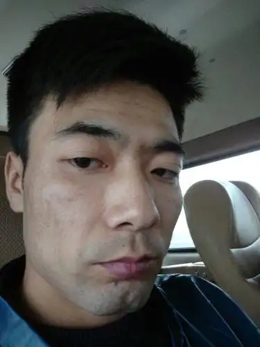 我今年32岁,男,现在皮肤发暗,感觉好多老人斑,用什么护肤品效果好,要