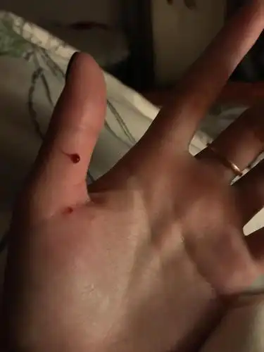 被自己养的猫咬了好伤心啊