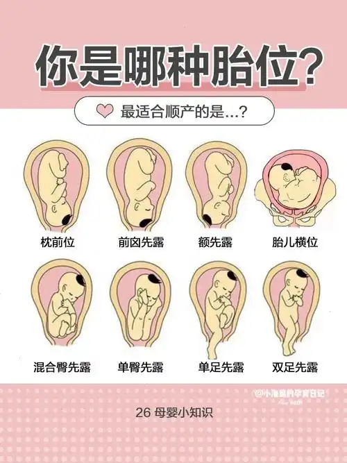 1分钟看懂你究竟是哪种胎位