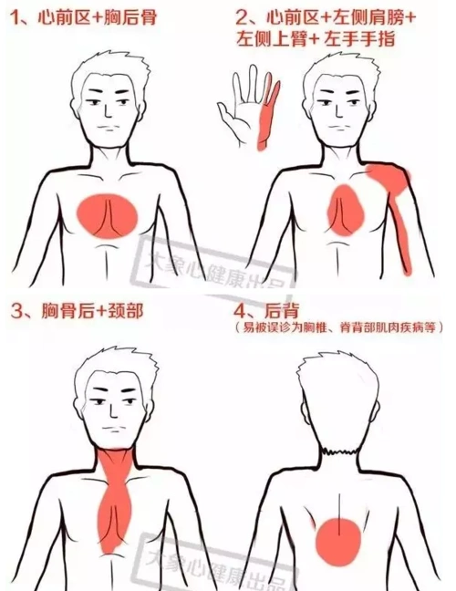 警惕这9个部位疼痛,可能暗示心梗!