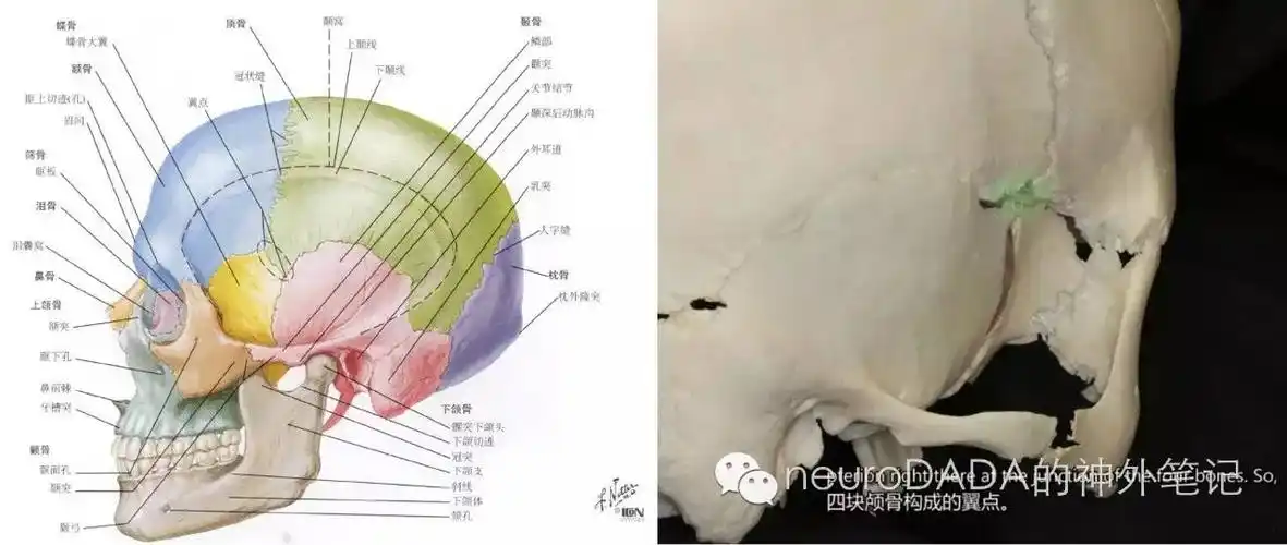 编年史翼点入路