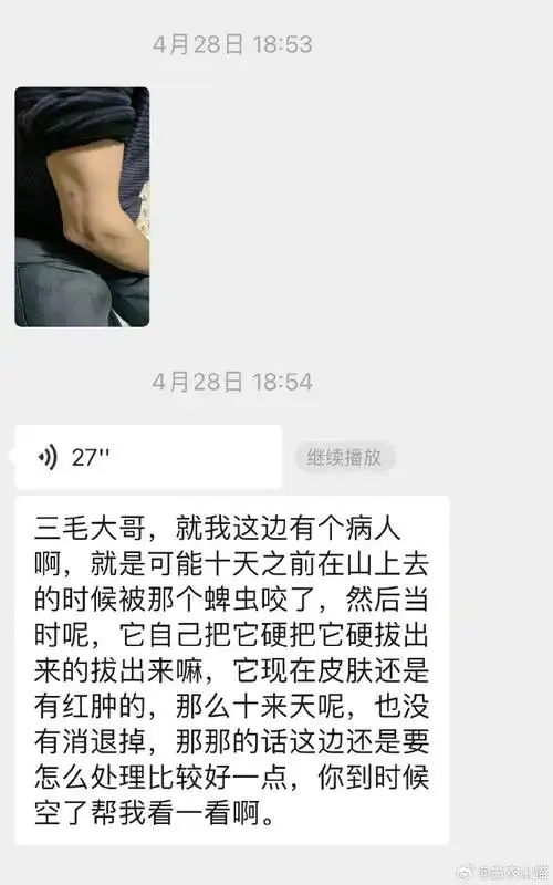 疾控在高烧老人家中找出近200只蜱虫##女子被虫咬后从发病到死亡仅