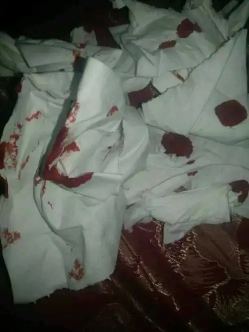 我背叛了男友,他在空间里发布了这个和一张带血的