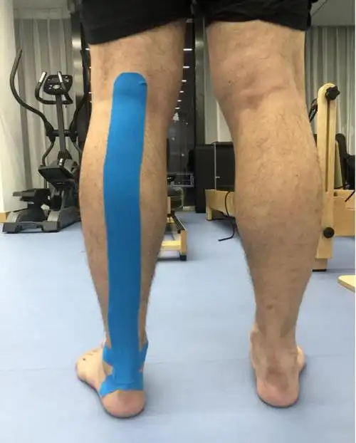 跟腱疼痛跟腱炎你最想知道答案的五个跟腱病问题