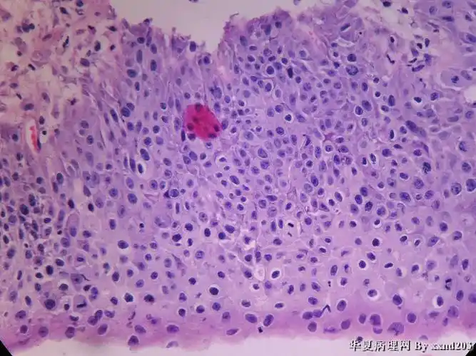 少许宫颈鳞状上皮