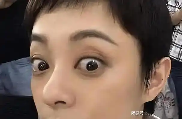 又搞笑又心疼! 孙俪眼睛大被质疑得甲亢, 霍思燕称嗯哼无腺样体