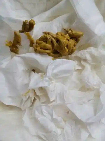 各位宝妈们,两个月的宝宝,混合喂养,拉的粑粑是细条状的,很臭,有点带