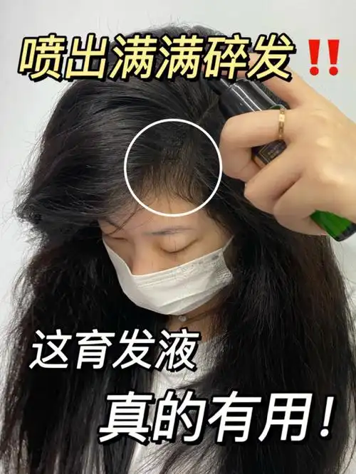 这育发液千万别用太多怕你头发多到收不住