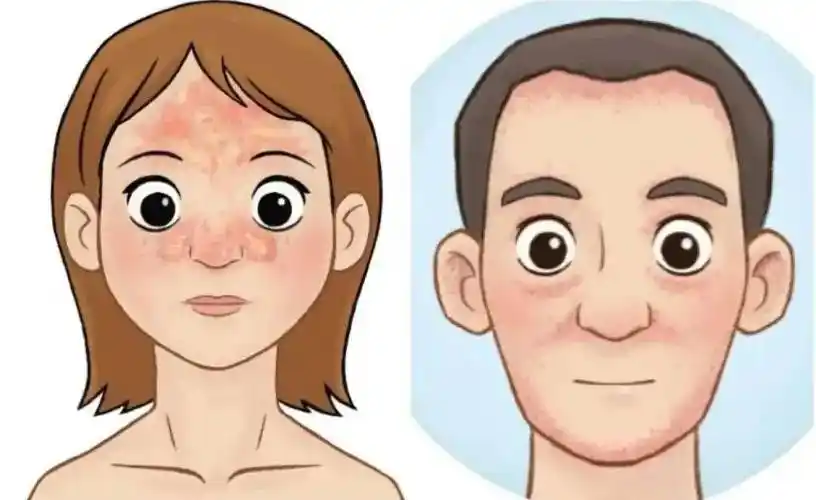 可能是皮肤微生态失衡了!