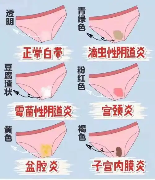 需要特定的条件,因为女性的阴道有一套自净系统,可以清除霉菌,但是这