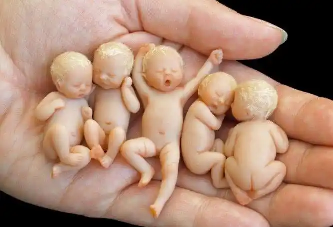 直击世界上最小的婴儿,捧在手心可爱到爆