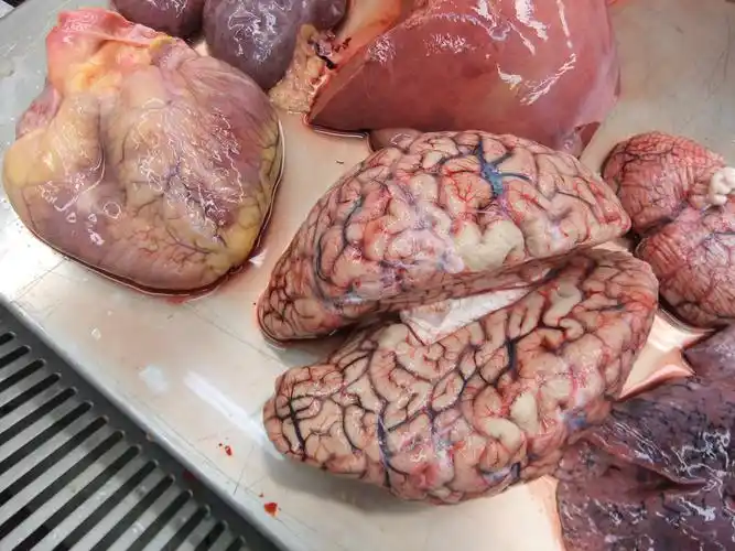 绵阳鼎立司法鉴定所 对肺动脉栓塞一例的法医病理鉴定(3月份录用)