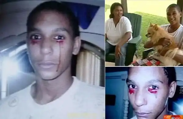 胆小者慎入!世界上真实存在的变异人