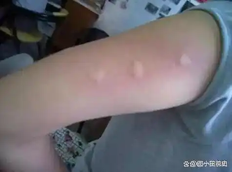 教你个土招数,整晚开窗也不用怕